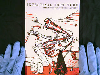 intestinal5.jpg