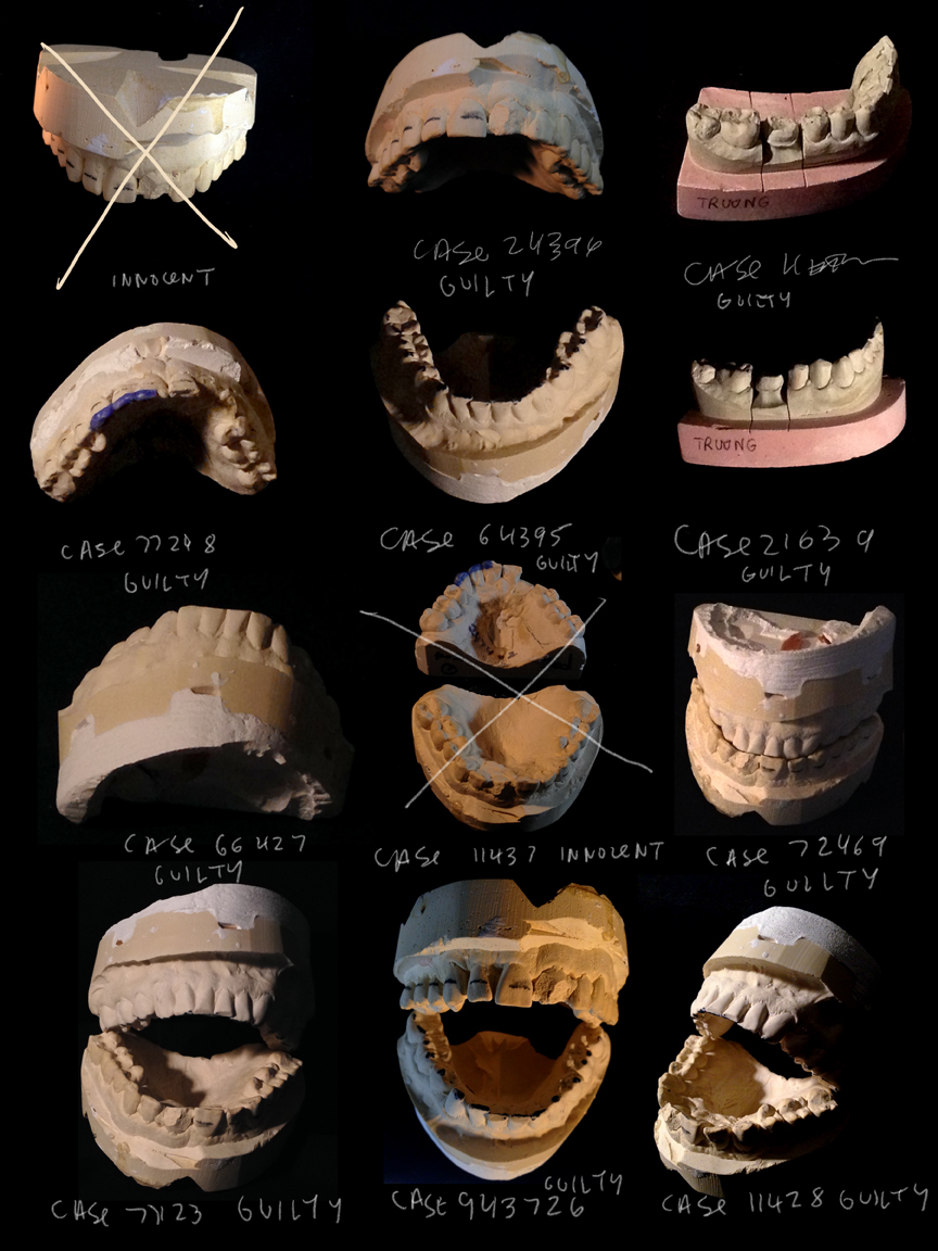 teeth_2.jpg